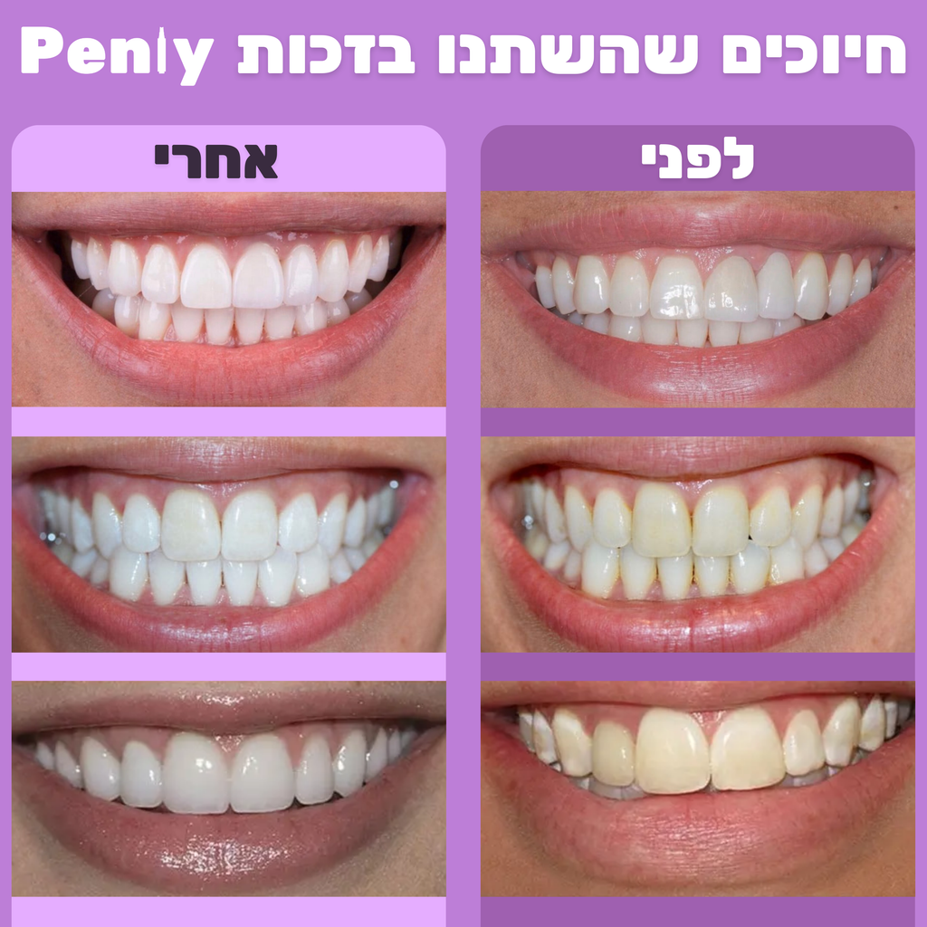 מארז ההלבנה של פנלי